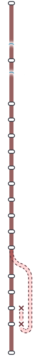 line